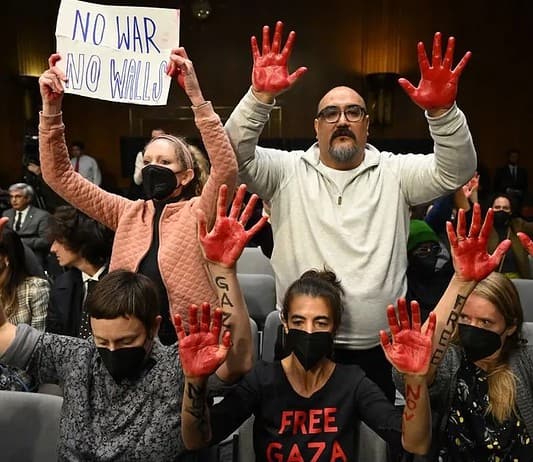 Γάζα: Χρειάστηκε να ακρωτηριάσουν άκρα παιδιών χωρίς αναισθησία!